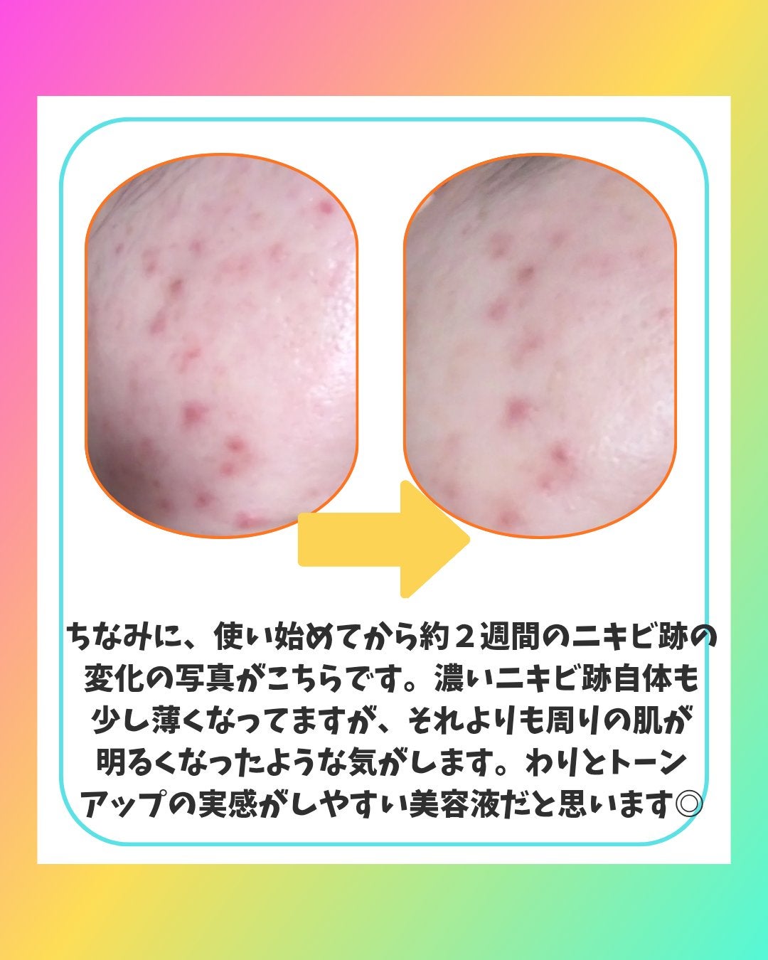 アットクリニックリンクルショットアンプル/DOMINAS/美容液を使ったクチコミ(4枚目)