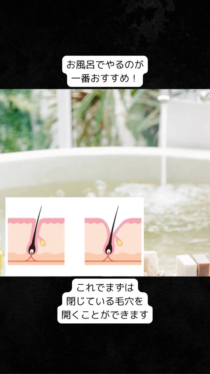 アネトス アクネケア トリートメント セラム/Anetos/美容液を使ったクチコミ（3枚目）