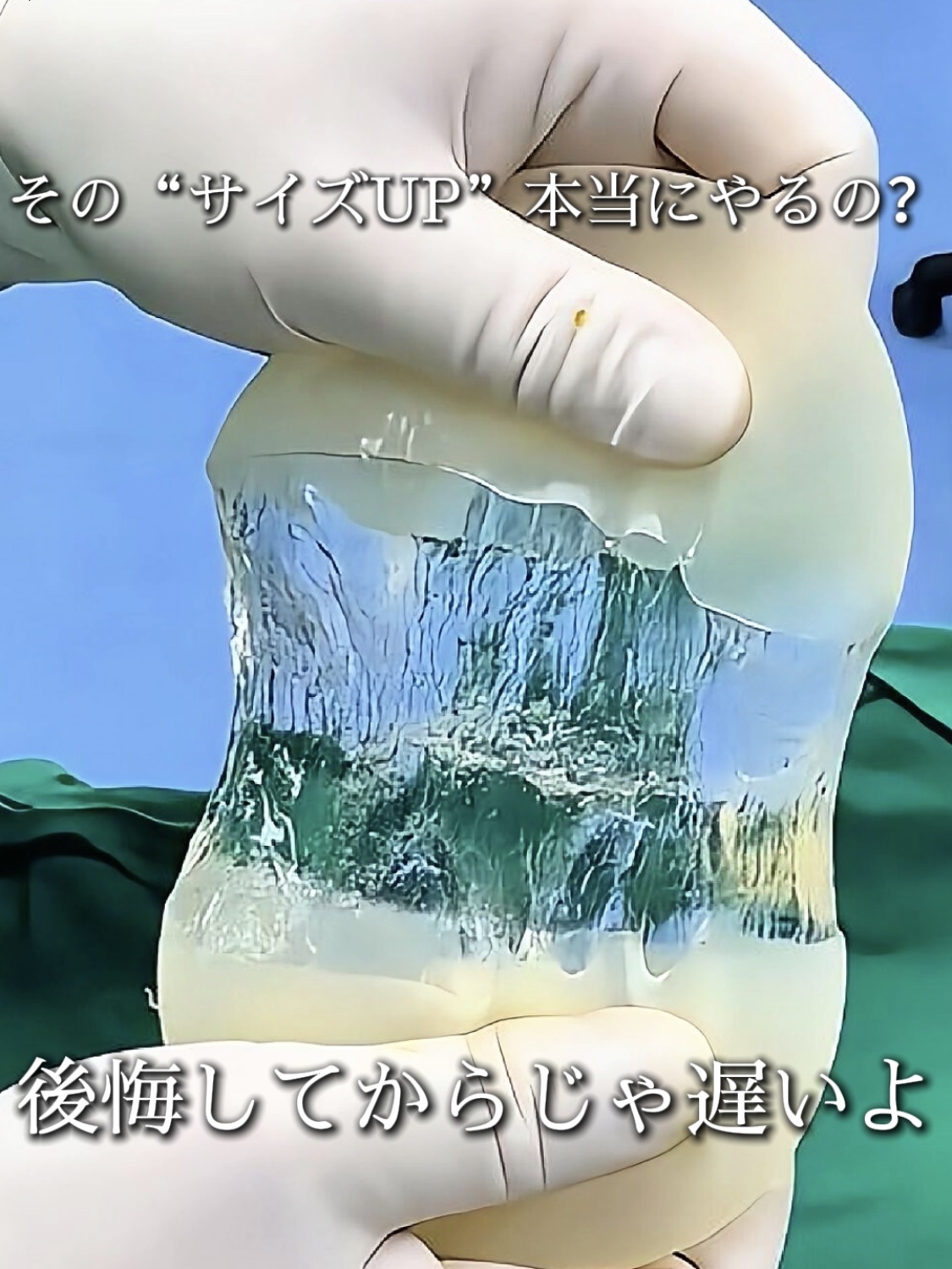 アネトス バランシング トリートメントクリーム/Anetos/フェイスクリームを使ったクチコミ（1枚目）