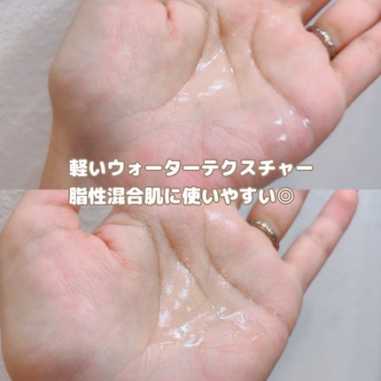 ベルプリモ ACセバムリデューサー/BELPRIMO/化粧水を使ったクチコミ(4枚目)