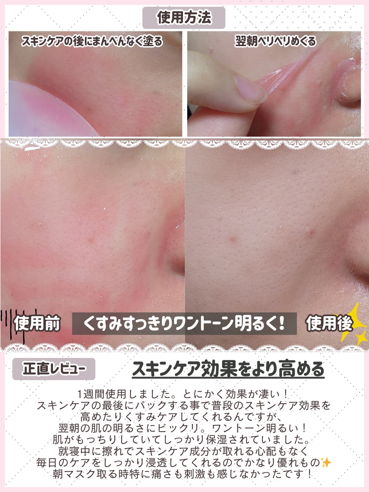 TXアスタキサンチントリプルブライトニングオーバーナイトラッピングマスク/Dr.Melaxin/シートマスク・パックを使ったクチコミ（3枚目）