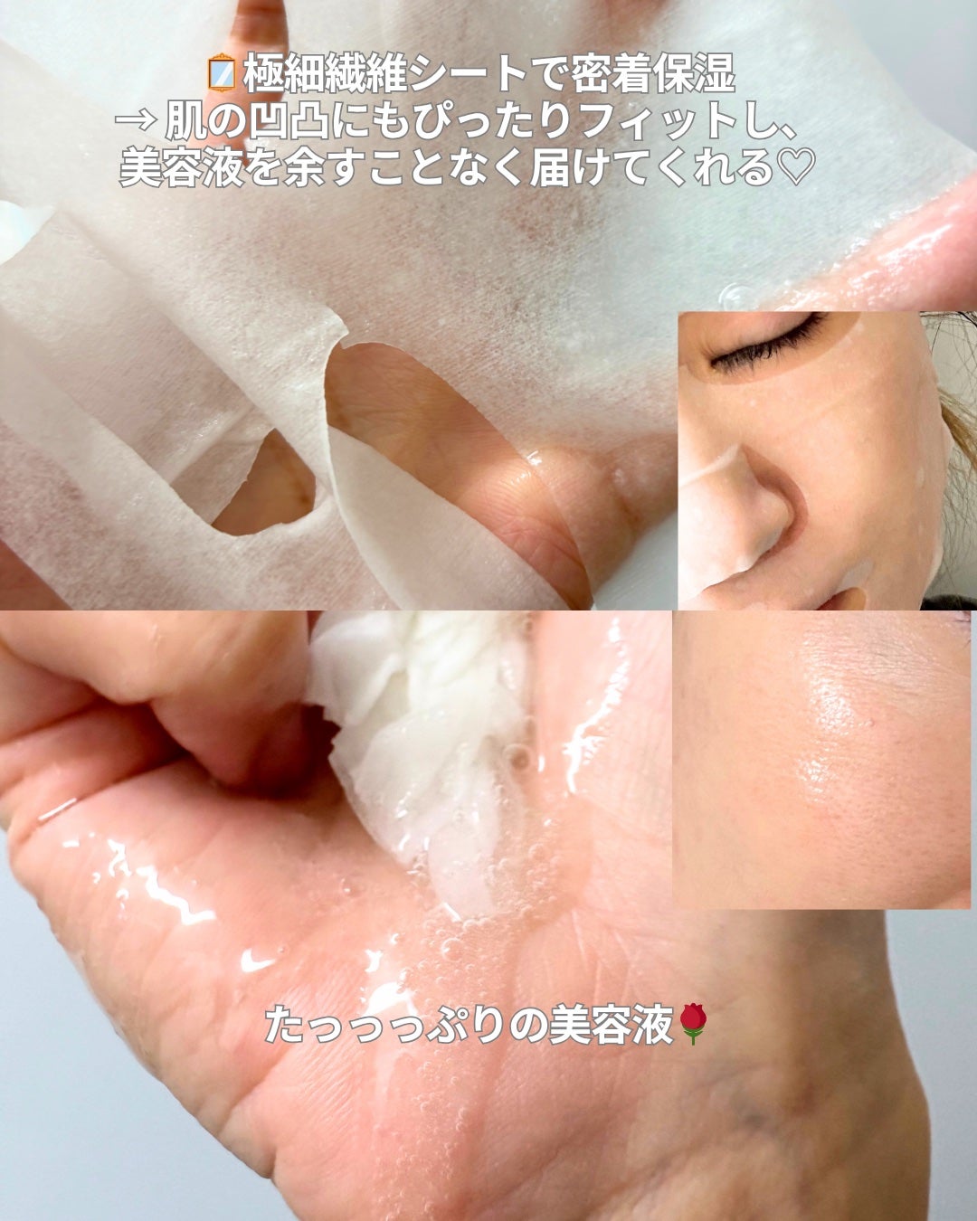 ローゼPDRNエッセンシャルマスクヘルシーグロウ/MEDIHEAL/シートマスク・パックを使ったクチコミ(3枚目)