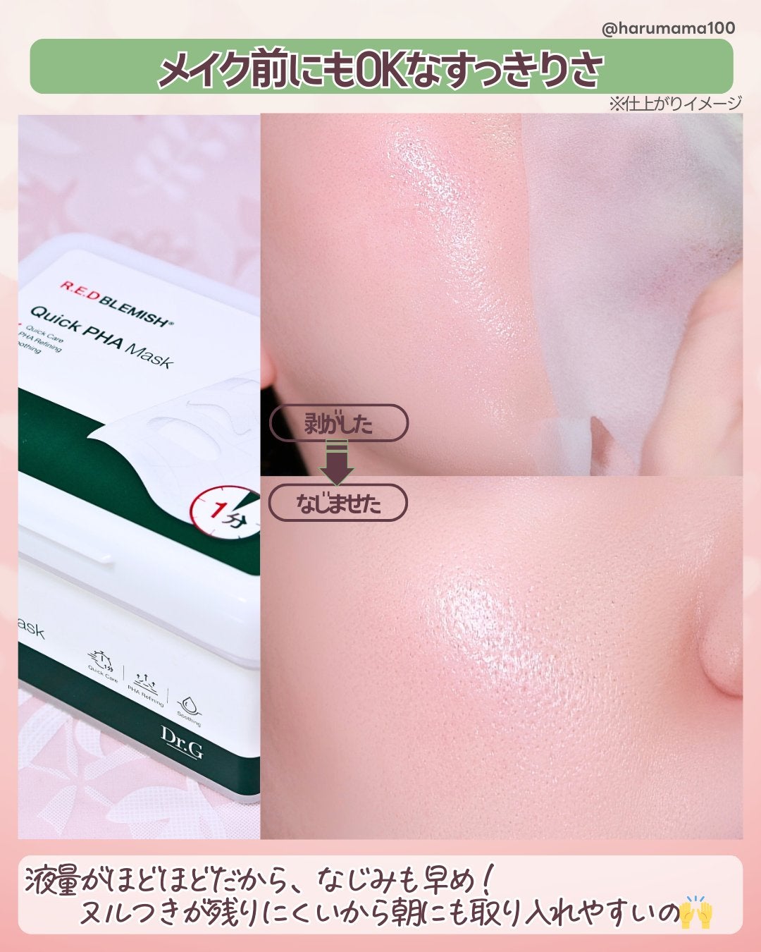 レッドブレミッシュクイックPHAシートマスク/Dr.G/シートマスク・パックを使ったクチコミ(6枚目)