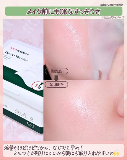 レッドブレミッシュクイックPHAシートマスク/Dr.G/シートマスク・パックを使ったクチコミ(6枚目)