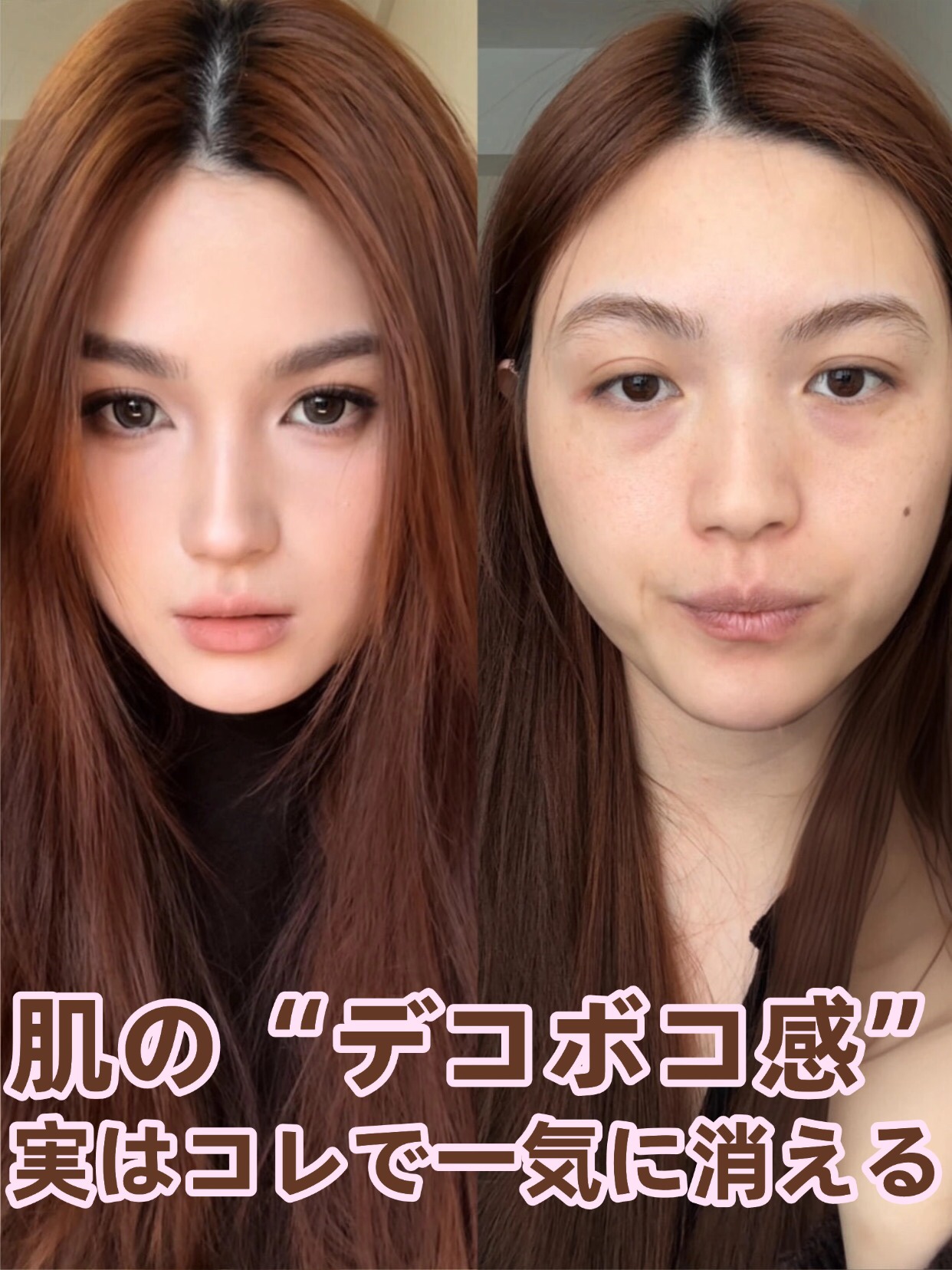 アネトス バランシング トリートメントクリーム/Anetos/フェイスクリームを使ったクチコミ（1枚目）