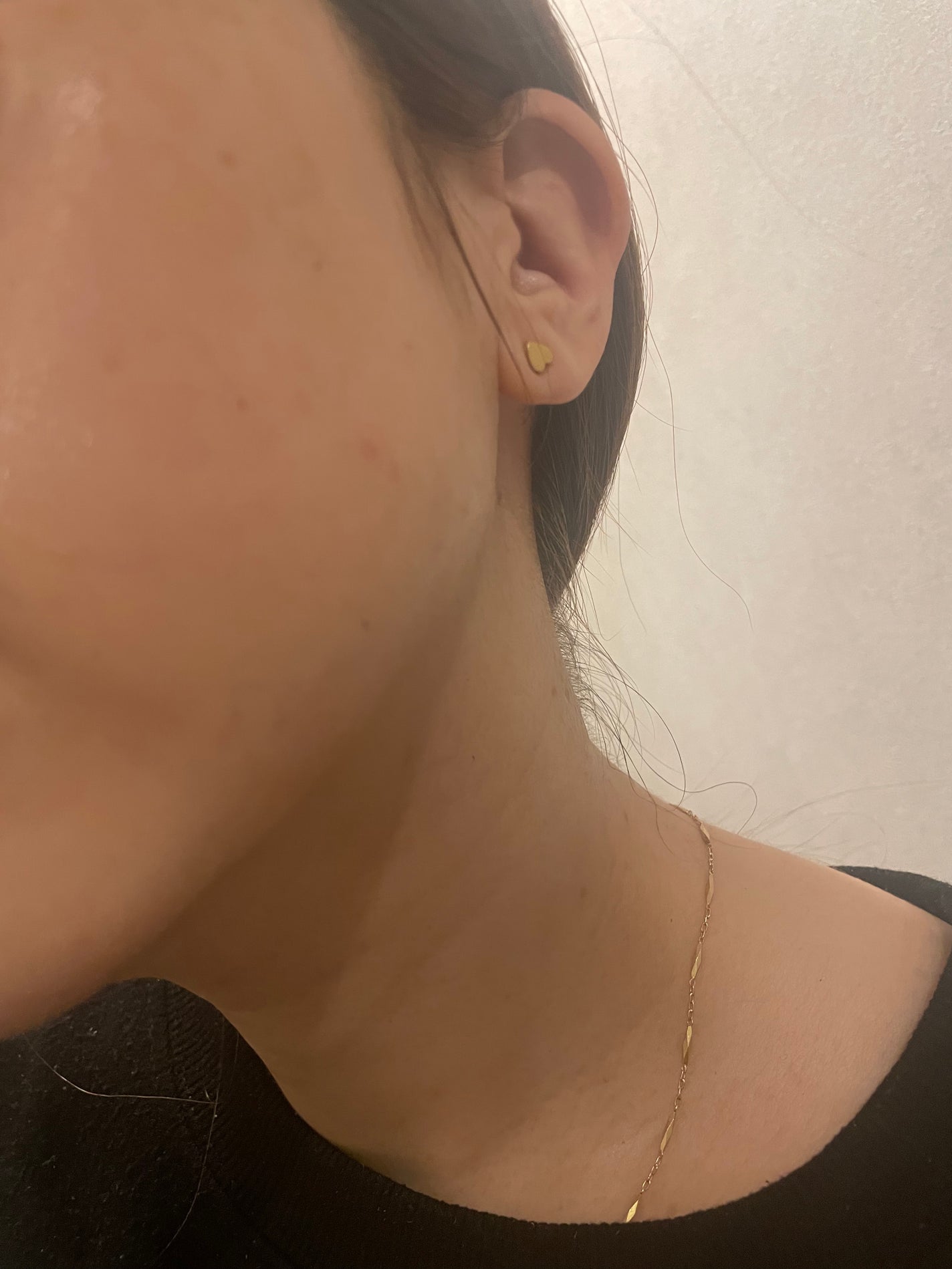 RXザ・アルファアルブチン2 ニキビ跡ケアセラム/COSRX/美容液を使ったクチコミ(5枚目)