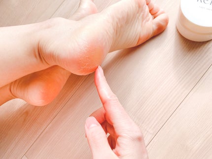 RELA かかとクリーム/RELA/レッグ・フットケアを使ったクチコミ(9枚目)