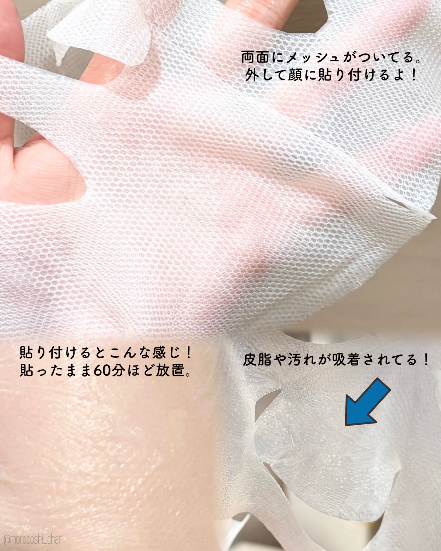 トラブルパッチマスク/EIOM/その他スキンケアを使ったクチコミ(3枚目)