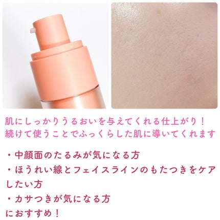 PDRNキューブセラム/DPPR/美容液を使ったクチコミ(4枚目)