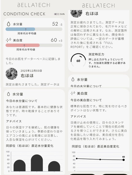 スキンスキャナー/BELLATECH/その他スキンケアグッズを使ったクチコミ(3枚目)