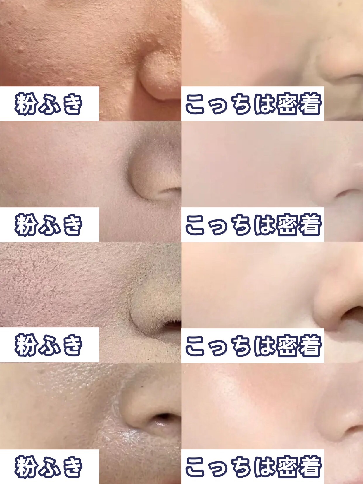 アネトス バランシング トリートメントクリーム/Anetos/フェイスクリームを使ったクチコミ（1枚目）