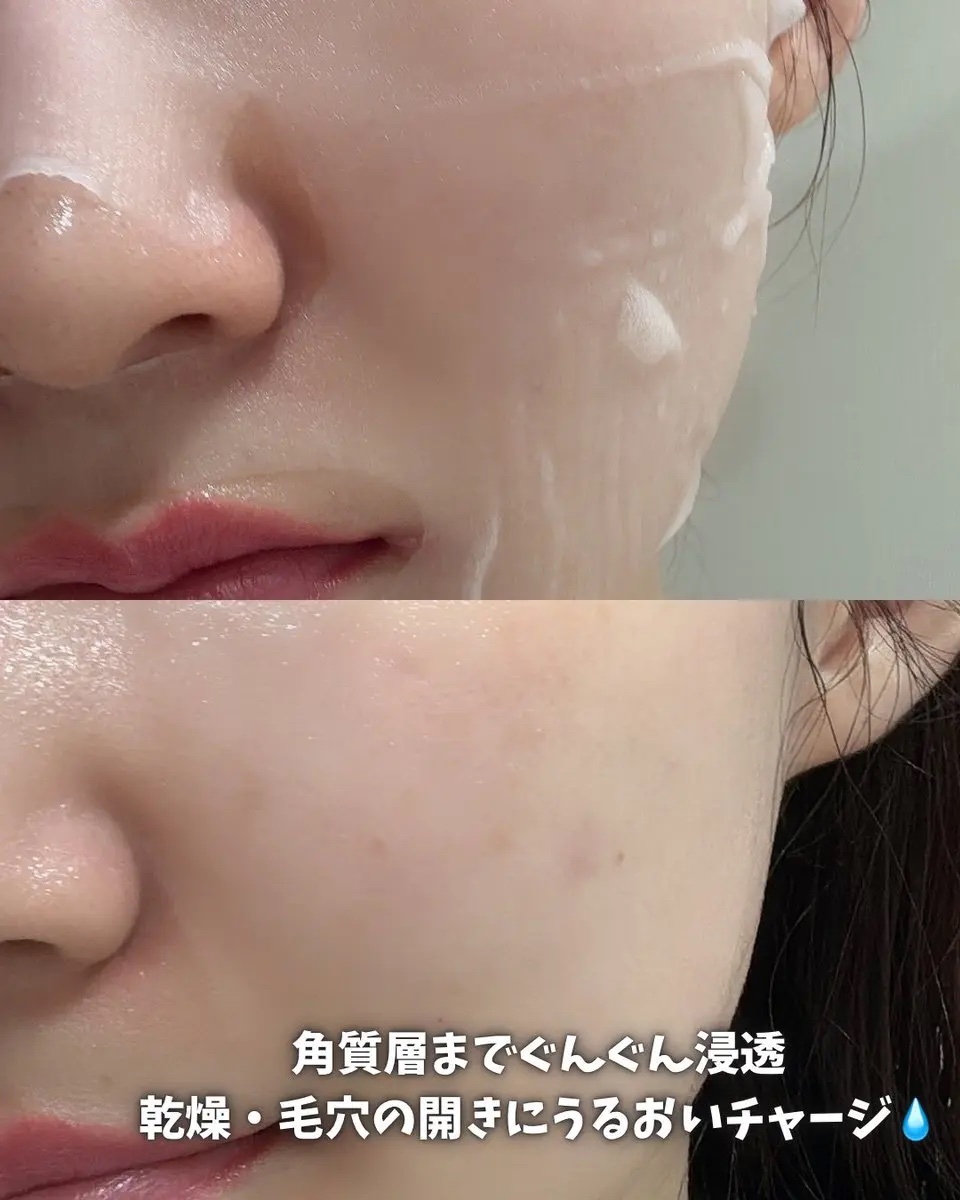 PDRN リフティングマスク/MEDIHEAL/シートマスク・パックを使ったクチコミ（3枚目）