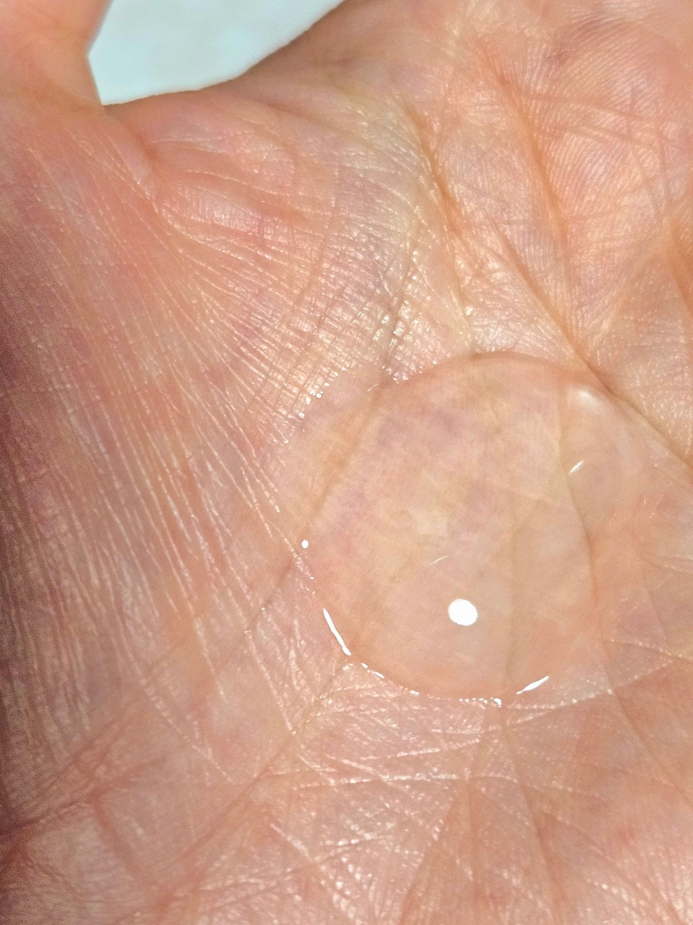 リカAソフト あせもジェル/ユースキン/ボディローションを使ったクチコミ(3枚目)