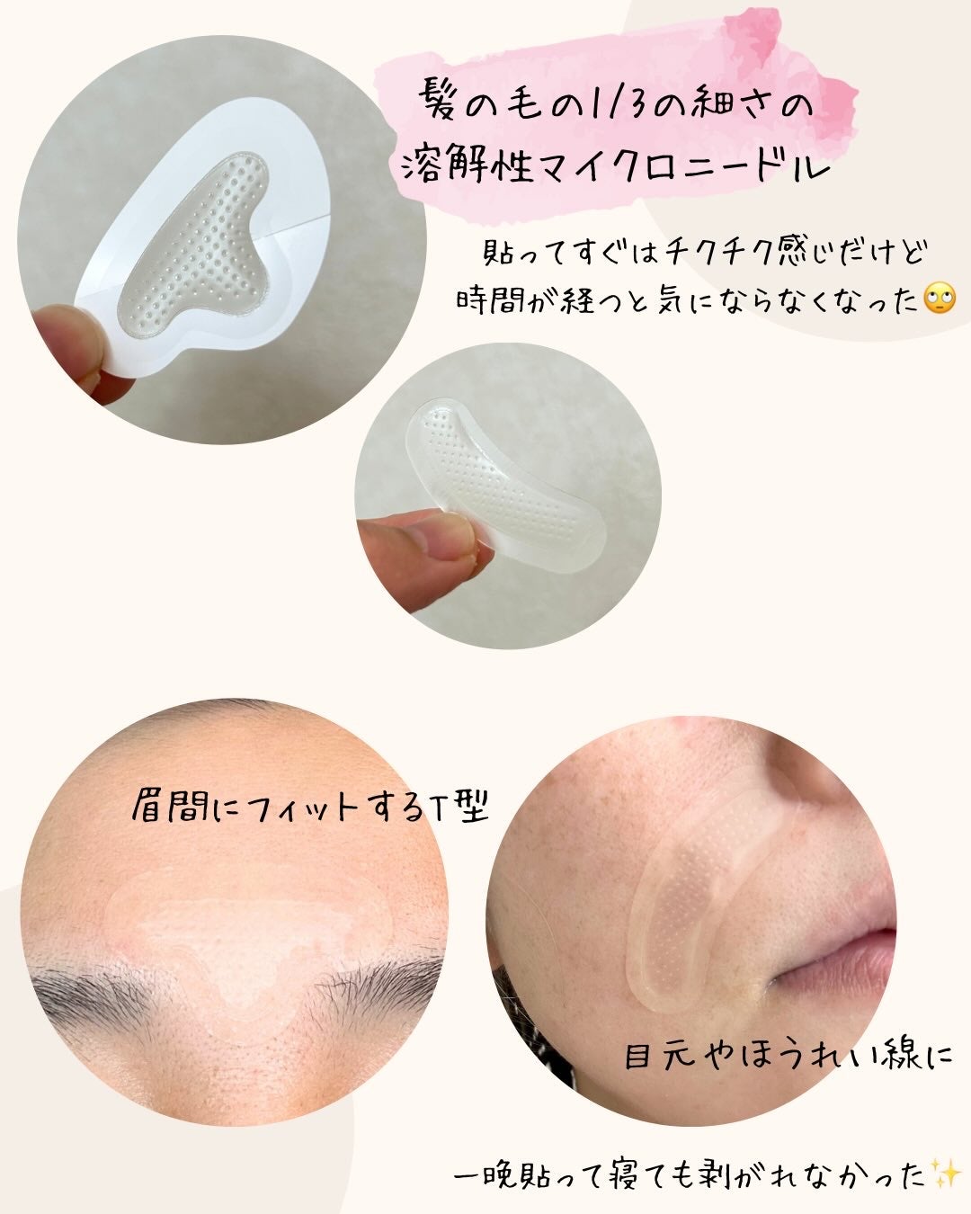 レチアールエヌ スリムパッチ/ACROPASS/シートマスク・パックを使ったクチコミ(2枚目)