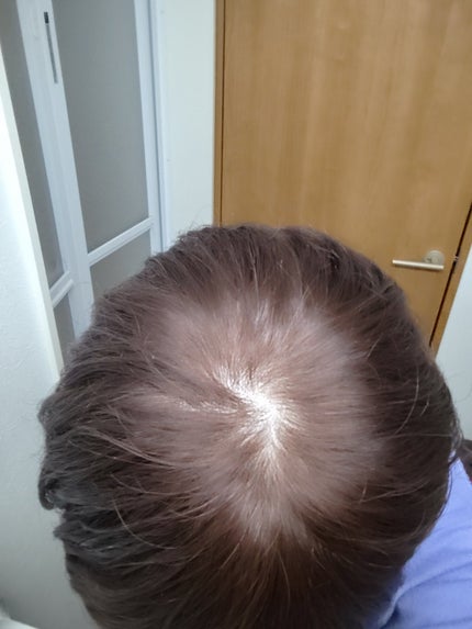 泡カラー/リーゼ/ヘアカラーを使ったクチコミ(3枚目)