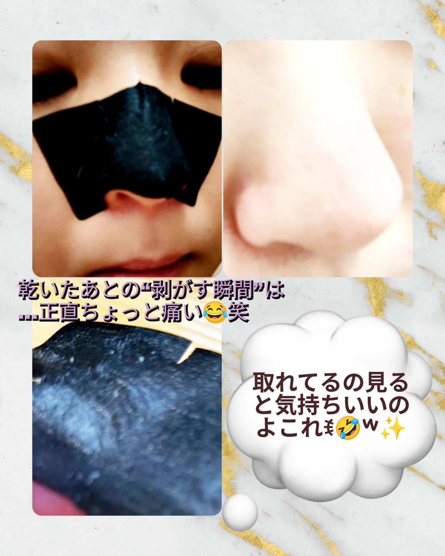 角栓すっきり黒パック N/メンズソフティモ/シートマスク・パックを使ったクチコミ(2枚目)