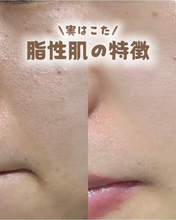 アネトス バランシング トリートメントクリーム/Anetos/フェイスクリームを使ったクチコミ(1枚目)