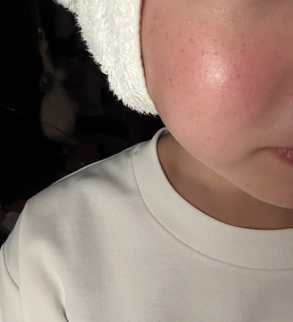 S-EGF エクソソームブーストショット美容液/SISTER ANN/美容液を使ったクチコミ（2枚目）