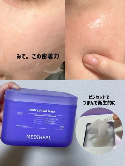 PDRN リフティングマスク/MEDIHEAL/シートマスク・パックを使ったクチコミ(2枚目)