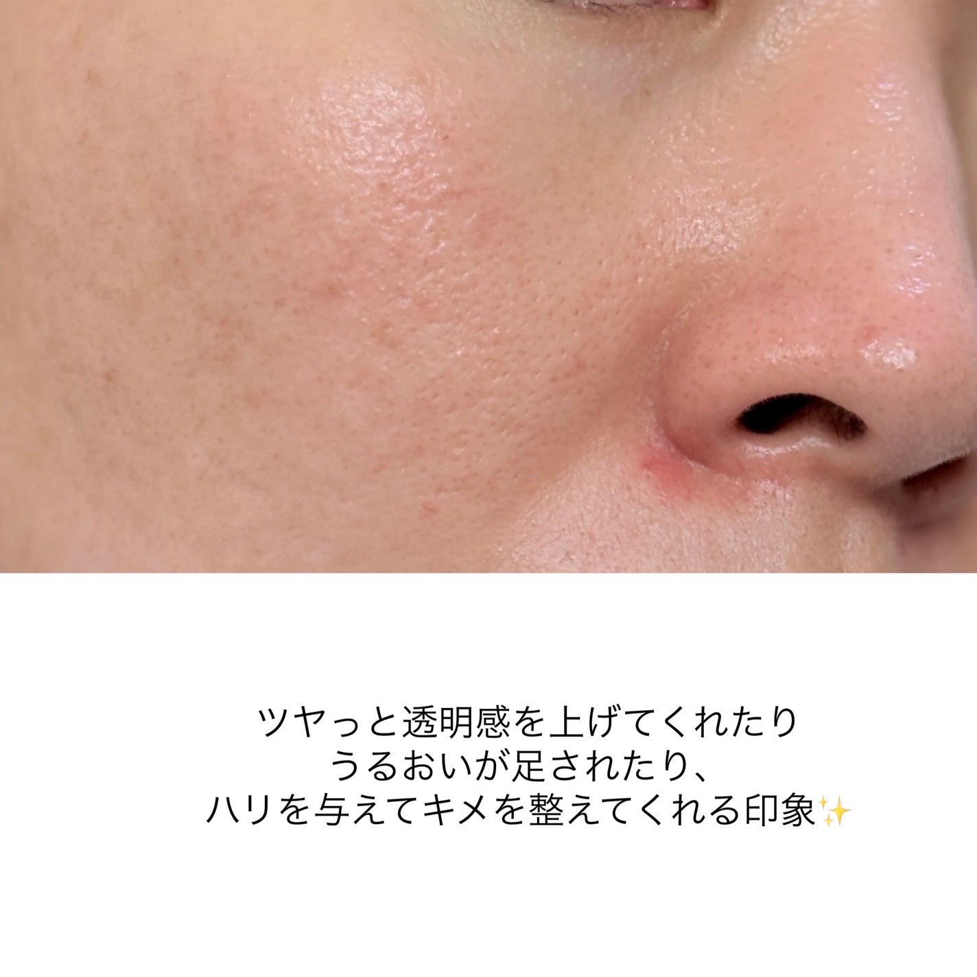 ã€ã³ãžã§ã¹ã¯ NM ïŒïŒïŒïŒïŒ ãã¥ãª ããªãã ã»ã©ã /INJESK/çŸå®¹æ¶²ã䜿ã£ãã¯ãã³ãïŒ7æç®ïŒ