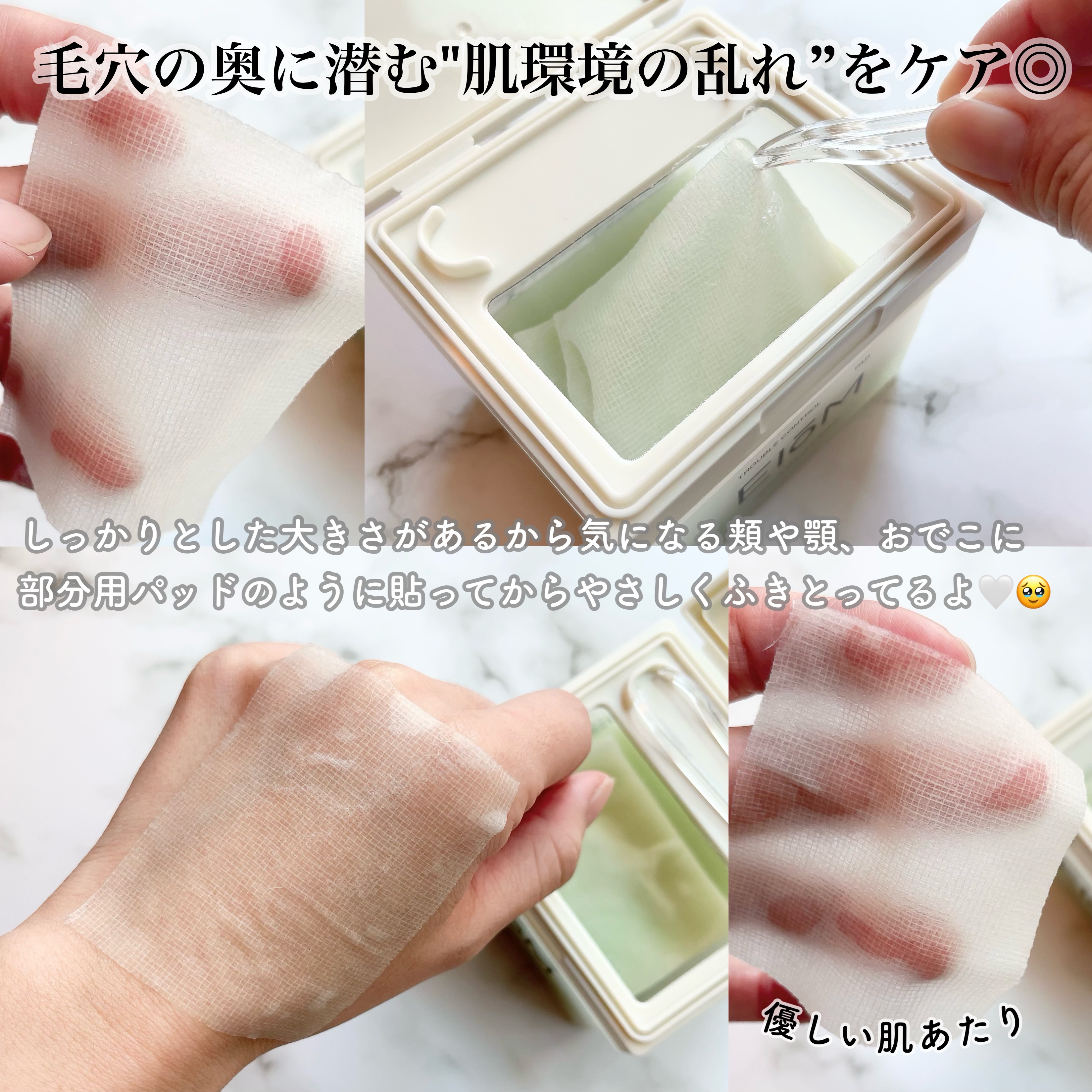 トラブルコントロールパッド/EIOM/トナーパッドを使ったクチコミ（3枚目）