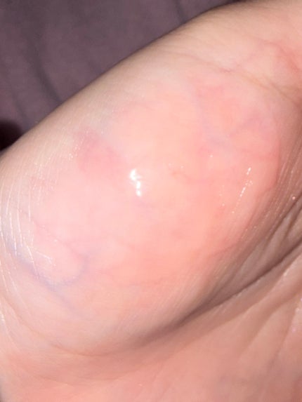 ミニュム バブリッププランパー/minum/リッププランパーを使ったクチコミ(4枚目)