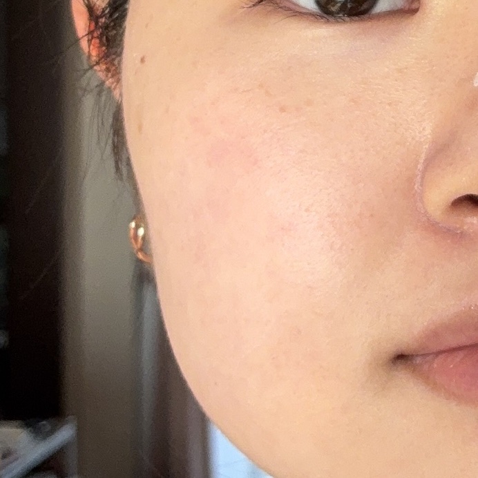 S-EGF エクソソームブーストショット美容液/SISTER ANN/美容液を使ったクチコミ（3枚目）