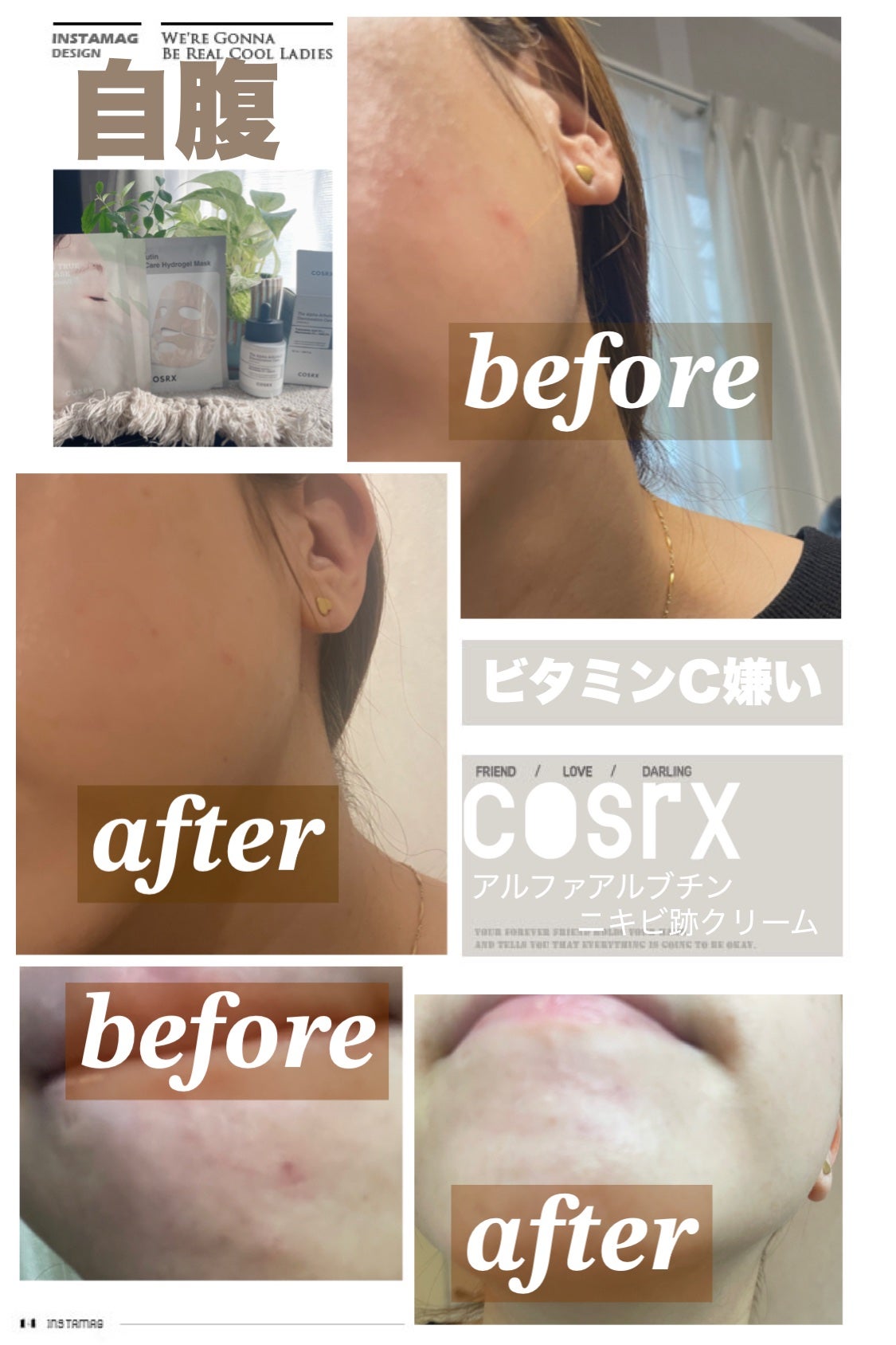 RXザ・アルファアルブチン2 ニキビ跡ケアセラム/COSRX/美容液を使ったクチコミ(1枚目)