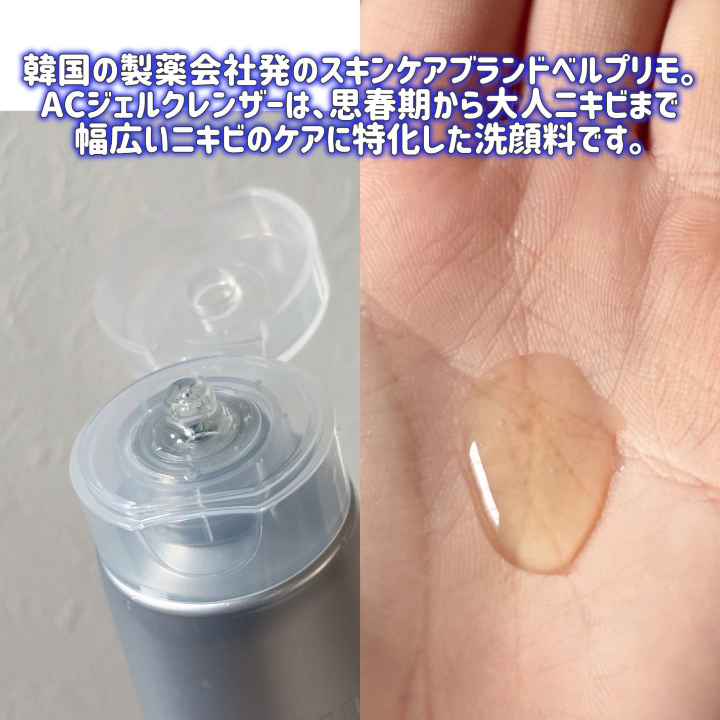 ベルプリモ ACジェルクレンザー/BELPRIMO/洗顔フォームを使ったクチコミ(2枚目)