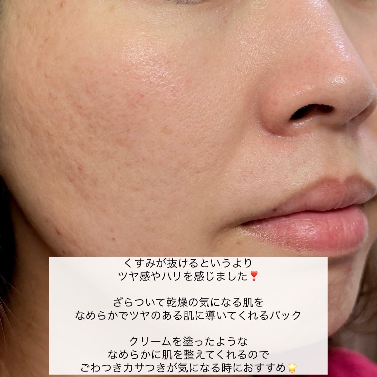 ホワイトトリュフナリシングトリートメントマスク/ダルバ/シートマスク・パックを使ったクチコミ(9枚目)