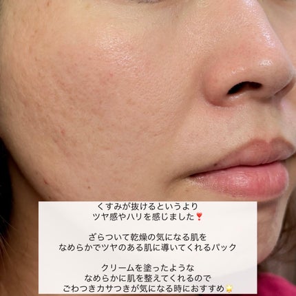 ホワイトトリュフナリシングトリートメントマスク/ダルバ/シートマスク・パックを使ったクチコミ(9枚目)