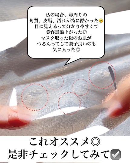 トラブルパッチマスク/EIOM/その他スキンケアを使ったクチコミ(6枚目)