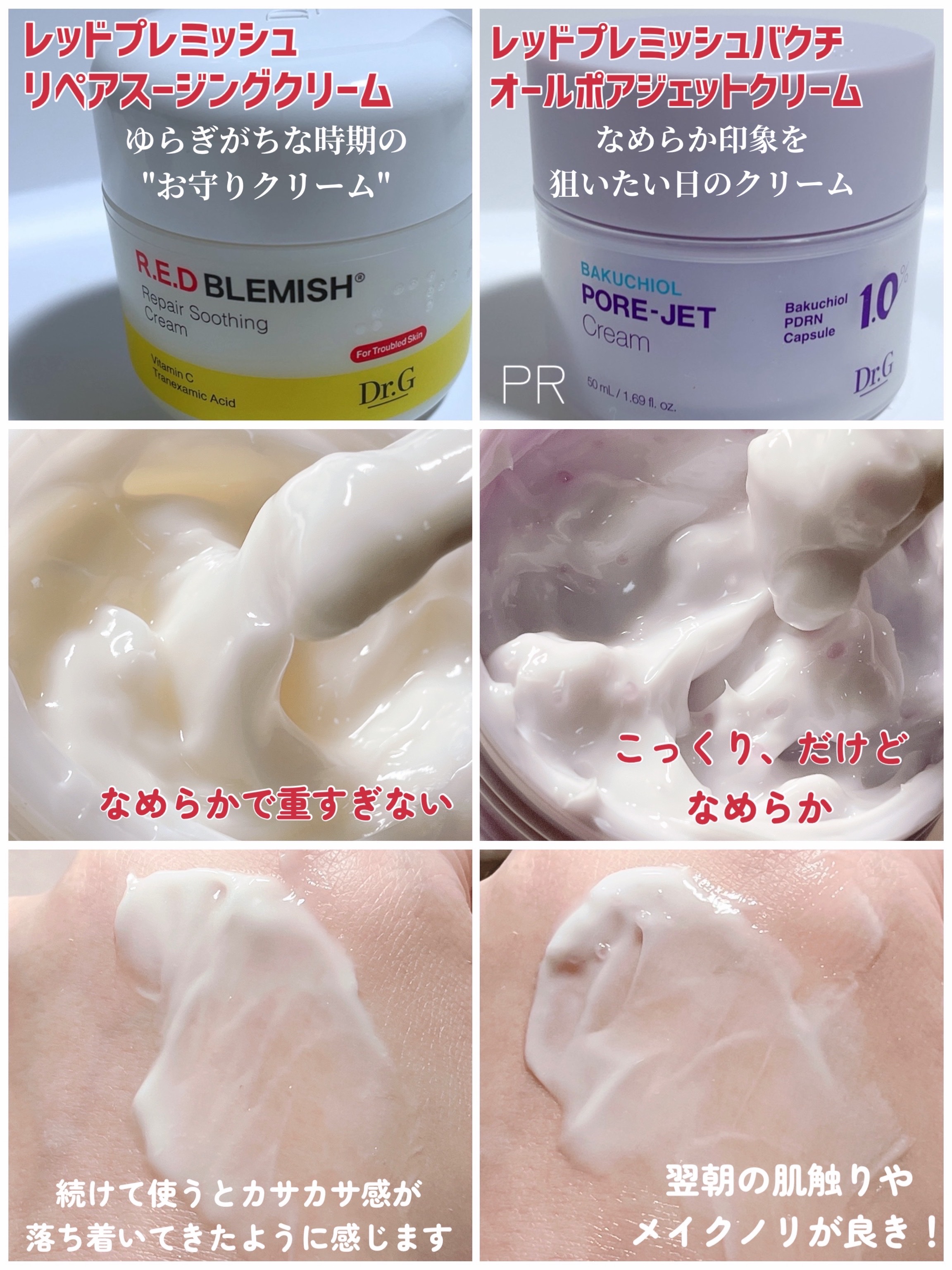 レッドブレミッシュ クリアスージングクリーム/Dr.G/フェイスクリームを使ったクチコミ（3枚目）