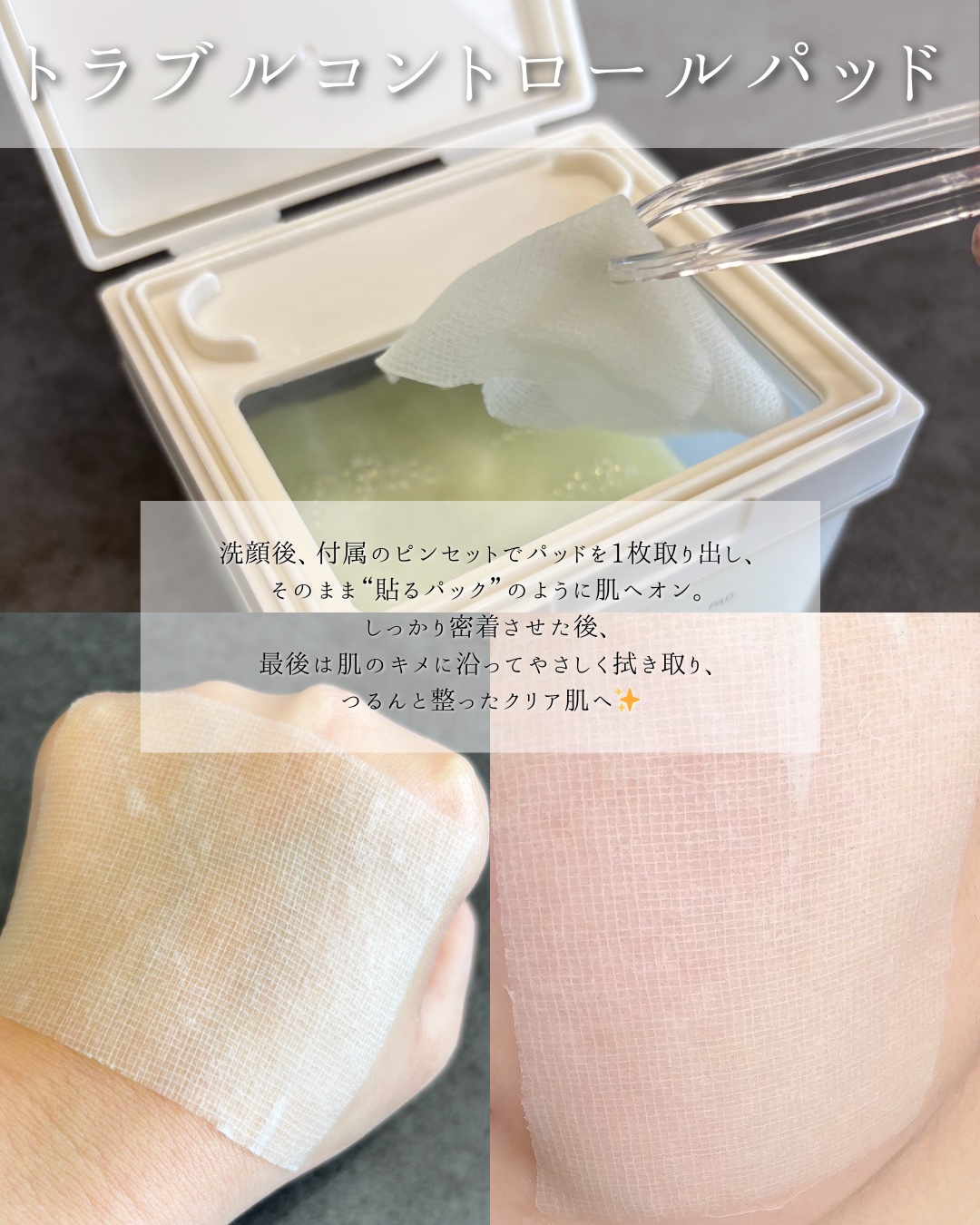 トラブルターゲティングセラム/EIOM/美容液を使ったクチコミ（3枚目）