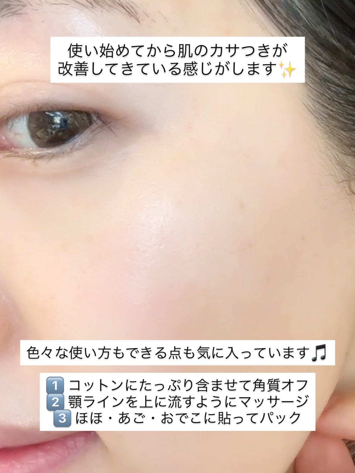 ライク ホワイト ブロッサム エッセンス トナー /GINGER6/化粧水を使ったクチコミ(5枚目)