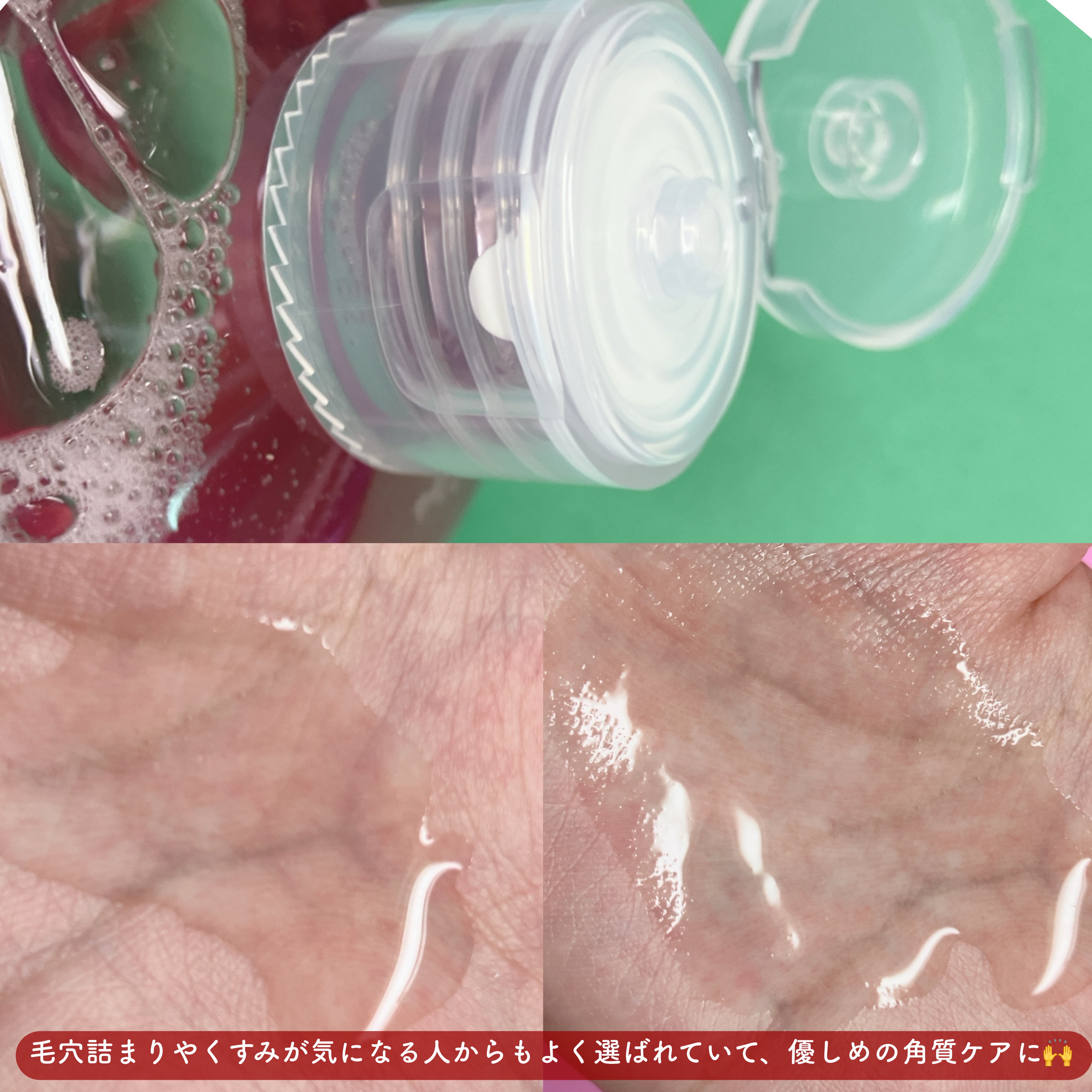 PDRN テンショントナーパッド/VT/トナーパッドを使ったクチコミ（3枚目）