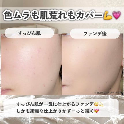 BARTHプレミアムリップクリーム/BARTH/リップクリームを使ったクチコミ(6枚目)