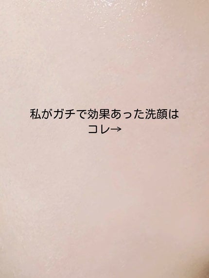 アネトス マイルド フェイシャル クレンザー/Anetos/洗顔フォームを使ったクチコミ(2枚目)