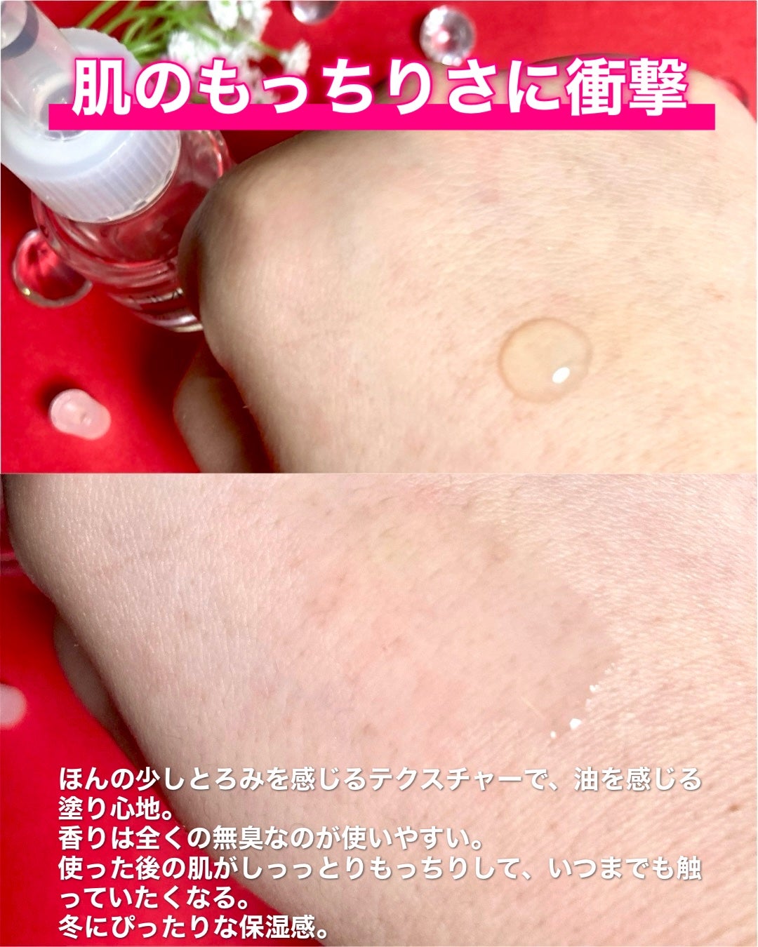 ã€ã³ãžã§ã¹ã¯ NM ïŒïŒïŒïŒïŒ ãã¥ãª ããªãã ã»ã©ã /INJESK/çŸå®¹æ¶²ã䜿ã£ãã¯ãã³ãïŒ6æç®ïŒ