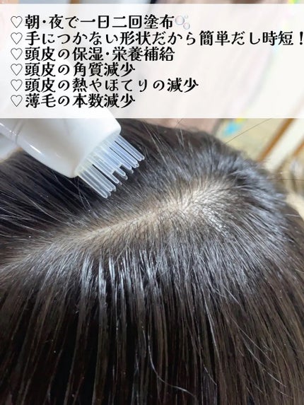 グローターンヘアアンプル/リリーイブ/頭皮ローションを使ったクチコミ(2枚目)