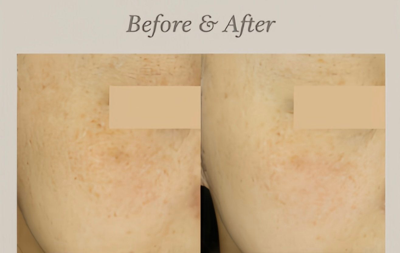 Lumiin_clinic_jp on LIPS 「もし気になるお肌のことがあれば、公式LINEを追加していただく..」(3枚目)