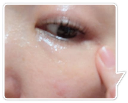 薬用アイクリームCL/ヴィオテラス/アイケア・アイクリームを使ったクチコミ(6枚目)