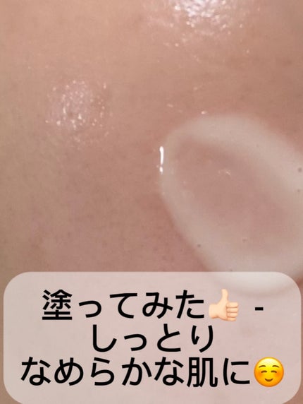 ユース ラディアンス ビタチノール セラム/primera/美容液を使ったクチコミ(4枚目)