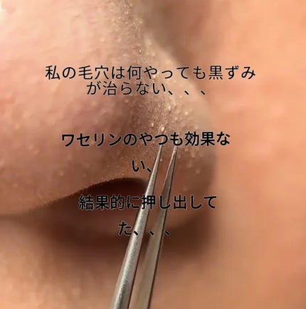 アネトス マイルド フェイシャル クレンザー/Anetos/洗顔フォームを使ったクチコミ(4枚目)