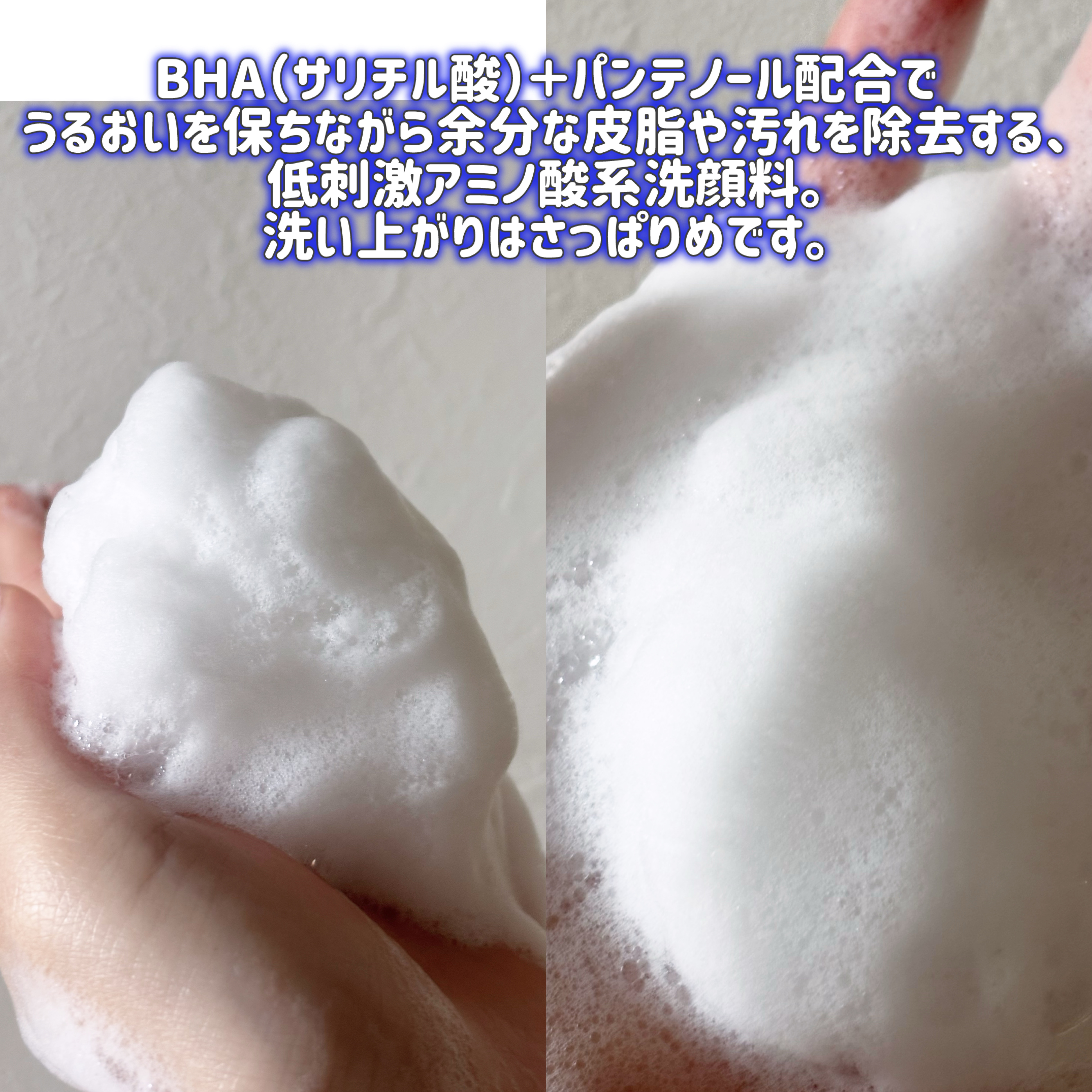 ベルプリモ ACジェルクレンザー/BELPRIMO/洗顔フォームを使ったクチコミ（3枚目）