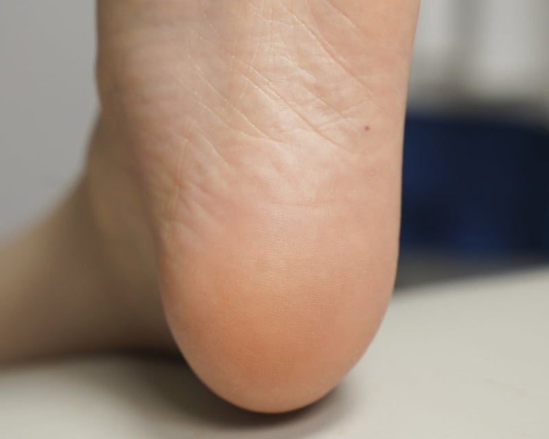 ユキのビューティー勉強部屋 on LIPS 「✨カカトのガサガサに感動!オリーブヤングで見つけた「すべすべ足..」(8枚目)