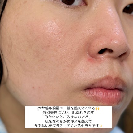 クローザーセラム/Frankly/美容液を使ったクチコミ(6枚目)