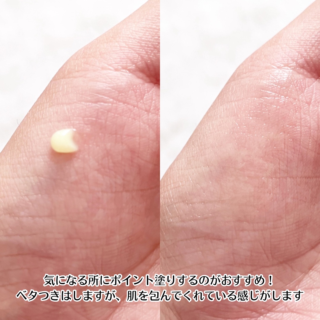 VITALIFT A forte/Dr.Different/フェイスクリームを使ったクチコミ（3枚目）