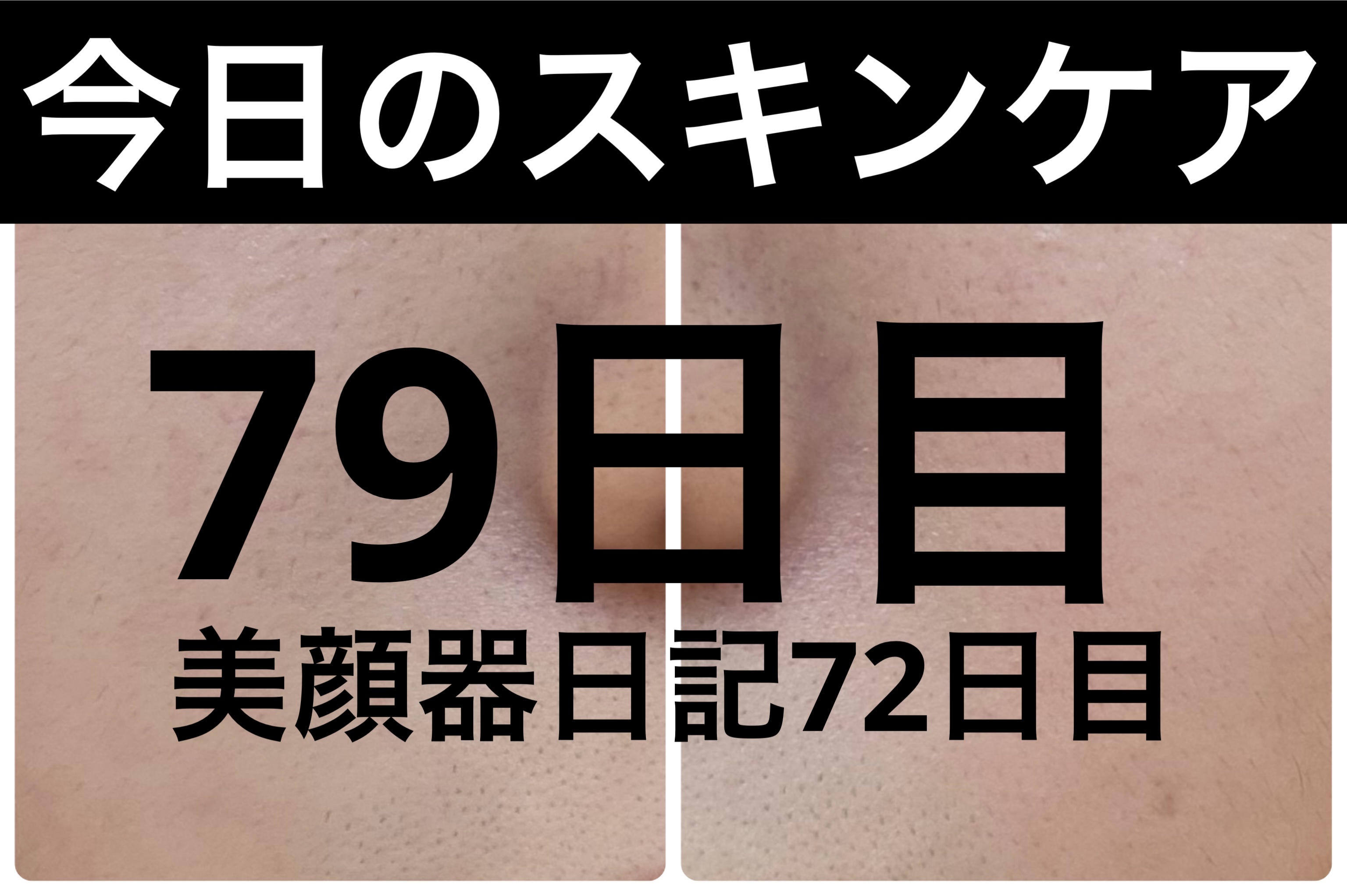 GLAM UP炭酸泡クレイマスク/GLAM UP/洗い流すパック・マスクを使ったクチコミ（1枚目）