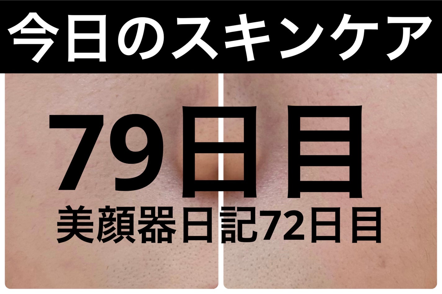 モーニングジェルウォッシュ/ビトレスキン/その他洗顔料を使ったクチコミ(1枚目)